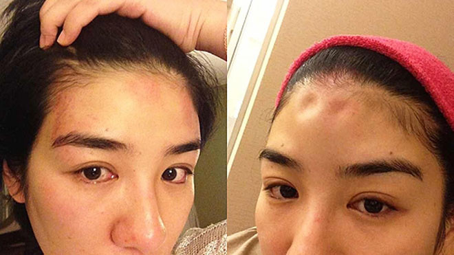 Huỳnh Dịch đăng tải những bức ảnh được cho là chứng cứ việc Hoàng Nghị Thanh đánh cô. 