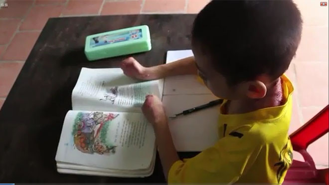 Nỗ lực tập viết của cậu bé bị dính liền ngón tay