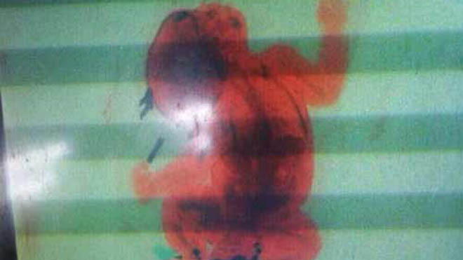 Hình ảnh chú bé hiện lên qua màn hình máy quét. Ảnh: News.