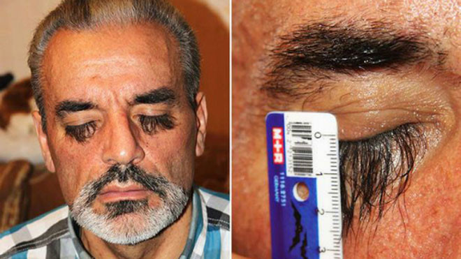 Thực phẩm bí mật giúp lông mi của ông Valery Smagliy dài nhanh chóng. Ảnh: Mirror.