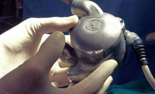 Thiết bị BiVACOR có đặc điểm khác với các thiết kế trước đây. Ảnh: Prince Charles Hospital