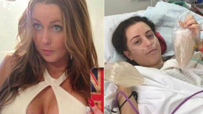 Courtney trước và sau khi điều trị nhiễm khuẩn do nâng ngực ở Thái Lan. Ảnh: Asiaone