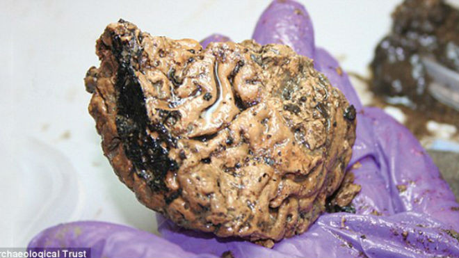 Sự thật đáng kinh ngạc về bộ não người có niên đại 2.600 năm