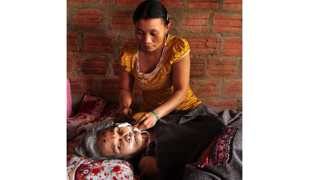 Bà Bé bị chuột cắn để lại thương tích đầy trên mặt đang được con dâu chăm sóc. Ảnh: Trí Tín (VnExpress). 