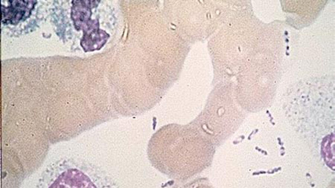 Vi khuẩn dịch hạch dưới kính hiển vi. 