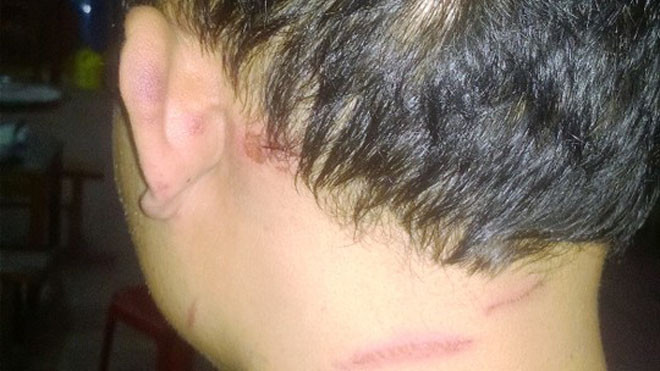 Những vết tích trên đầu mà anh Lê Thanh Hải cho rằng mình bị công an xã đánh