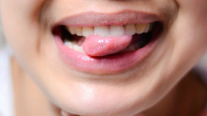 Ung thư lưỡi dễ bị bỏ qua vì nhầm với nhiệt miệng. Ảnh minh họa