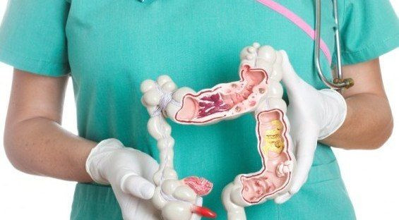 Viêm đại tràng có nhiều ổ viêm loét