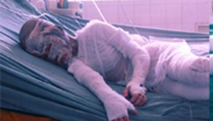 Bị cấm yêu cô chủ 11 tuổi, gã làm công tạt axit cả nhà