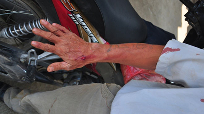 Cởi áo khoe súng rồi cướp xe ôm ở Sài Gòn