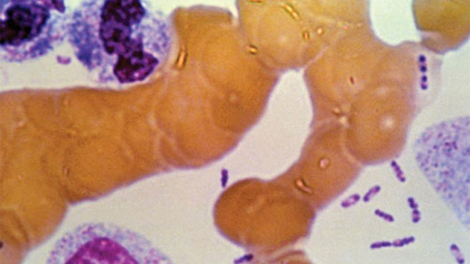 Tồn tại hơn 2.000 năm qua, dịch hạch đã gây ra 4 trận đại dịch với số tử vong khủng khiếp trong lịch sử nhân loại. Ảnh: Amazone. 