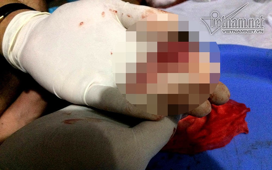 Chàng sinh viên 2 năm đi nhặt 3.000 xác thai nhi