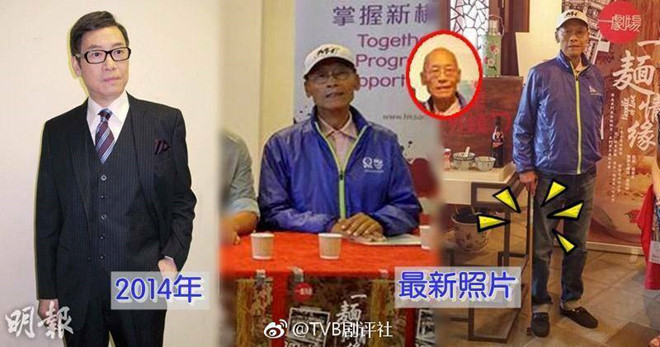 Nhạc Hoa gầy gò và ốm yếu từ giữa năm 2017. Ông sụt cân trông thấy so với trước đó