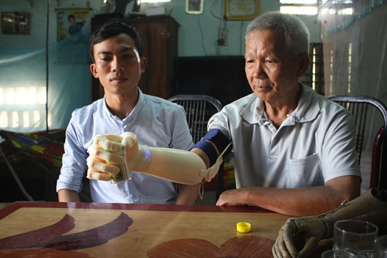 Sinh viên Ngô Văn Dết chế tạo bàn tay robot cho người khuyết tật sử dụng