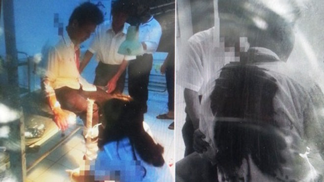 Nạn nhân Vũ Văn Quạt đang được y bác sĩ Trạm y tế xã Thụy Phong sơ cứu.