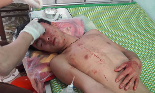 Học sinh Tài điều trị tại bệnh viện.