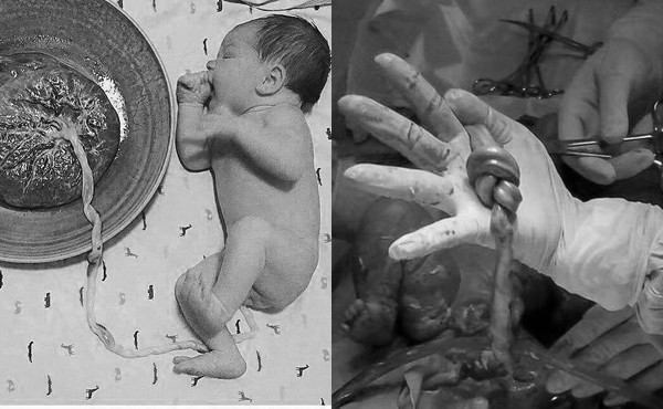 Bà bầu 18 tuổi ở Hà Nội sắp đẻ mà không biết