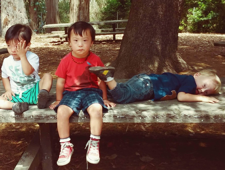 1001 lý do trẻ dễ bị tai nạn, chấn thương vào mùa hè