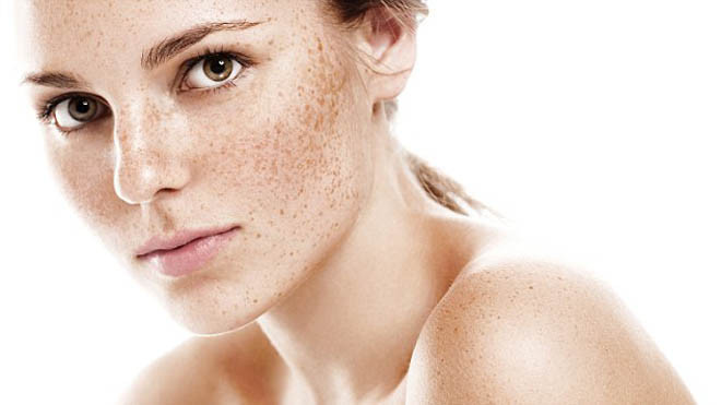 Tăng sắc tố, tàn nhang và da không đều màu đều có thể do tổn thương ôxy hóa và mất cân bằng hooc môn