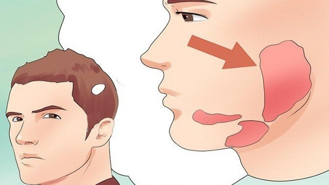 Cha đốt rạ chữa quai bị, con biến chứng viêm màng não