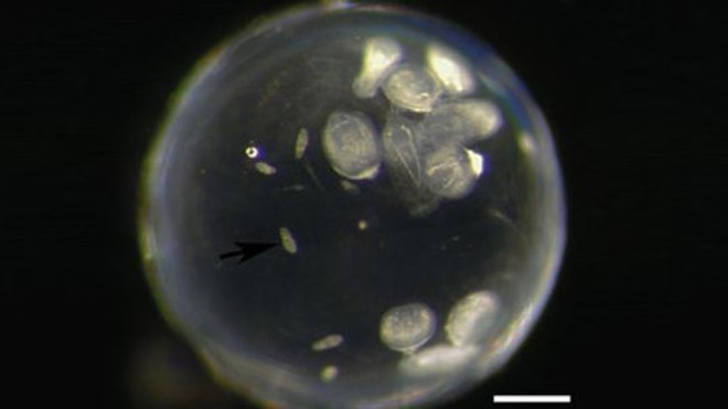 Khủng khiếp loài ký sinh trùng sống trong mắt, điều khiển não vật chủ