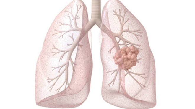 Ảnh minh họa: benhungthu.