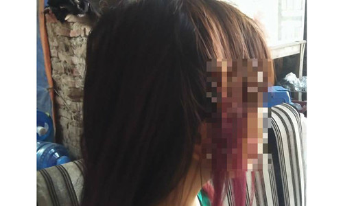 Số tiền được "siêu cò" buôn trứng, mang thai hộ đưa ra khiến nhiều cô gái mờ mắt