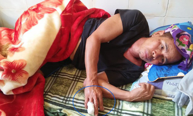 Ông Nhân được đưa đến cấp cứu tại Trung tâm Y tế huyện Quế Phong.