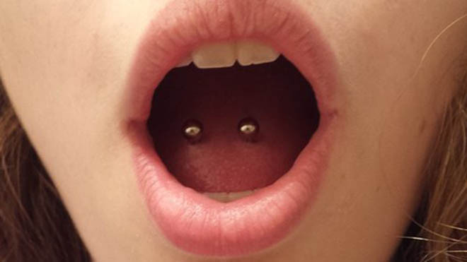Tác hại khủng khiếp của việc xỏ khuyên lưỡi