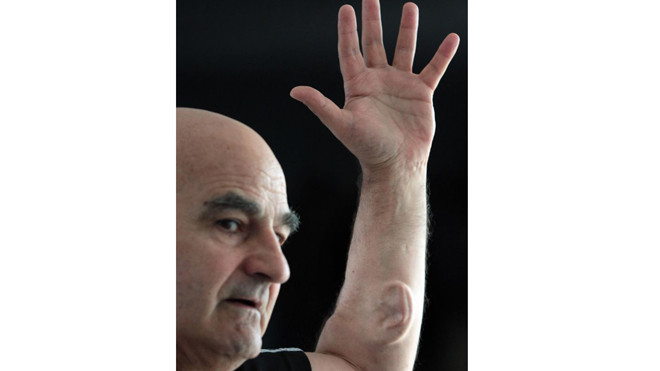 Tai 'mọc' trên cánh tay có thể kết nối wifi