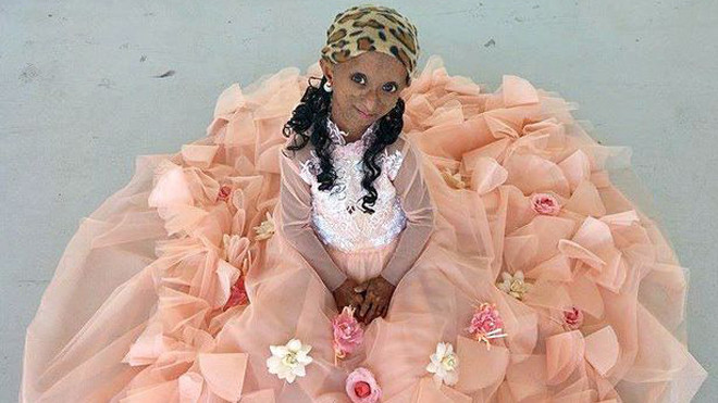 Rochelle Pondare có bề ngoài như một cụ già dù mới 18 tuổi. Ảnh: Discovery/Bacroft.