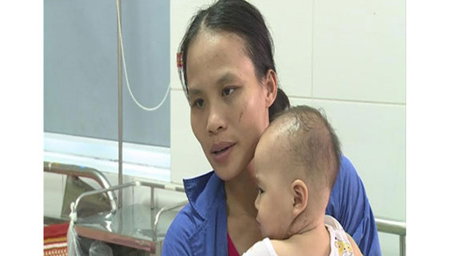  Bệnh nhiễm khuẩn nguy hiểm giống quai bị khiến trẻ nguy kịch