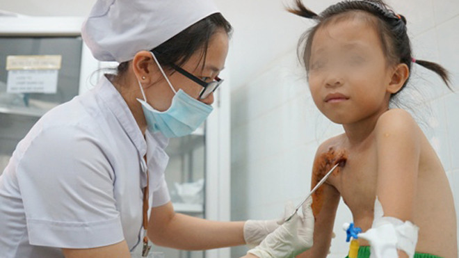 Cậu bé nghịch súng bắn 10 viên đạn vào ngực em gái