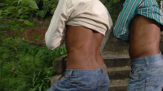 Làng bán thận ở Nepal