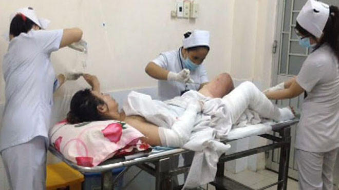 Bình ga xì khi đang nấu ăn, một phụ nữ bị bỏng nặng