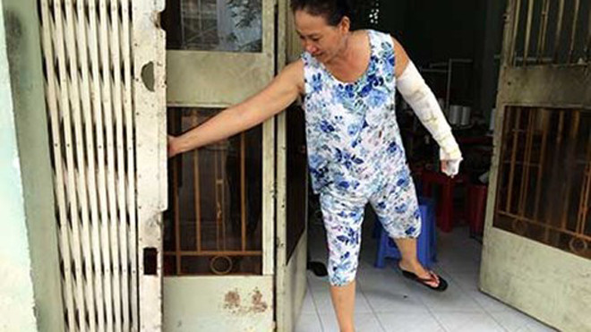 Từ vụ hai nhóm HS va chạm, chị H. bị bỏng nặng cánh tay trái, cửa nhà cùng một số đồ đạc bị cháy xém. Ảnh: TK