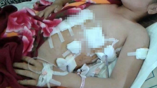 Na khi đang được cấp cứu tại Bệnh viện (ảnh nhân vật cung cấp)