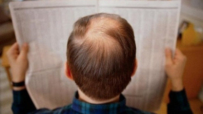 Cách giúp tóc bạc thành tóc đen.