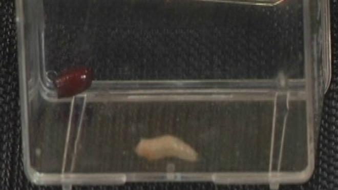 Giòi được sử dụng để tăng tốc độ loại bỏ các mô chết, làm giảm vi khuẩn trong vết thương. Ảnh: Channel News Asia