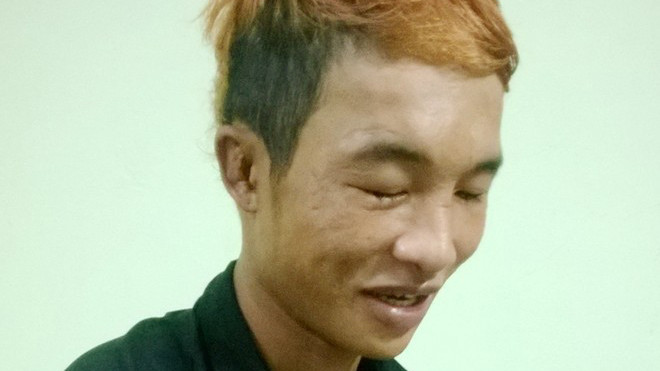 Mắt phải của Hào Anh bị loét giác mạc rất nặng nhưng cậu phớt lờ khuyến cáo của bác sĩ. Sáng 5/9, bà Thoa đưa con nhập viện. 