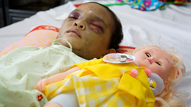 Việc giao bé gái chịu nhiều thiệt thòi này cho ai nuôi dưỡng sẽ được cơ quan chức năng cân nhắc, xem xét kỹ. 