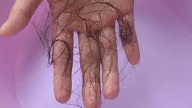 Ảnh minh họa: Internet