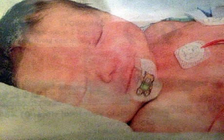 Các bác sĩ đã chăm sóc Maisy Vignes trong lồng kính ngay sau khi họ tiến hành mổ lấy thai nhi. Ảnh: Telegraph.