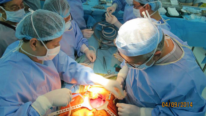 Ca phẫu thuật ghép gan cho bệnh nhi Minh Hân tại BV Nhi đồng 2. Ảnh: BVCC.