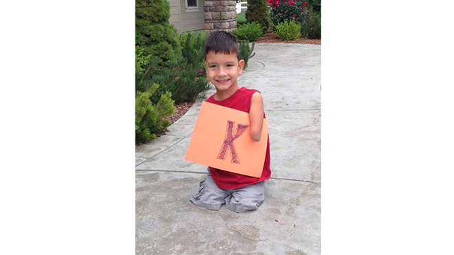 Bé Bowen được vợ chồng cô Doven Toomey, người Mỹ, nhận nuôi từ một nhà trẻ mồ côi ở Serbia lúci 18 tháng tuổi. Ảnh: Today