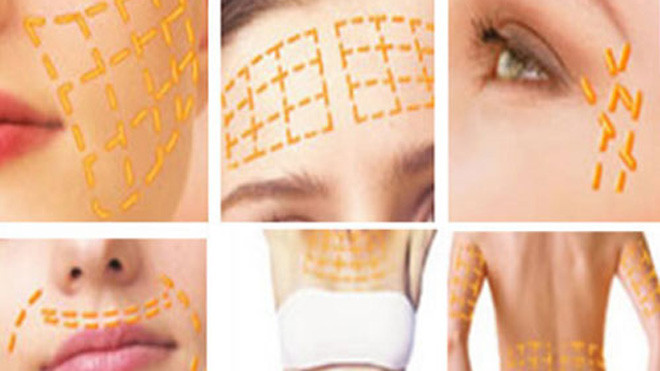 Quảng bá căng da bằng vàng, với giá cả hàng ngàn USD của mỹ viện KangNam (Hà Nội) - Ảnh: T.T