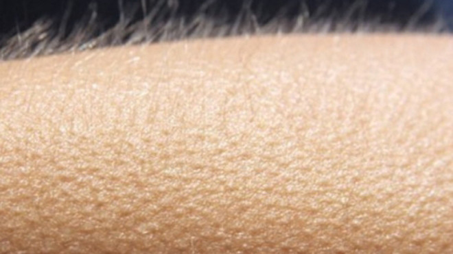 Phản ứng nổi da gà khi trời lạnh.