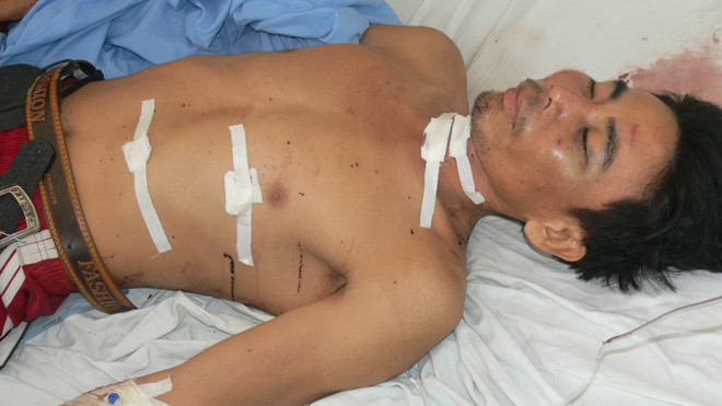 Ông Lê Văn Chi tại bệnh viện