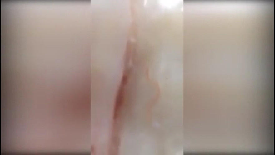 Rùng mình với sinh vật lạ trong thịt ở siêu thị