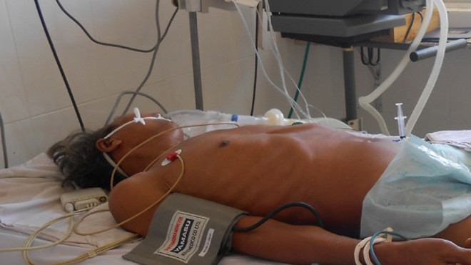 Ông Điểu Mỏn đã tử vong sau 3 ngày điều trị tại bệnh viện.